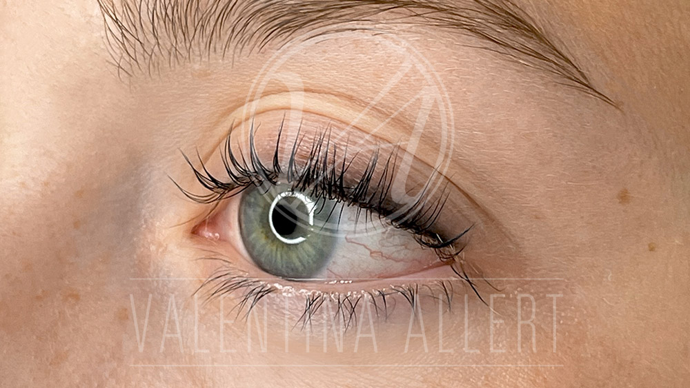 valentina-allert-pmu-ergebnis-augenlid